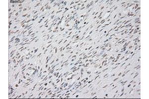 Immunohistochemistry (IHC) image for anti-Keratin 8 (KRT8) (AA 91-381) antibody (ABIN1491713)