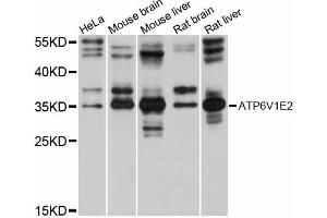 Western blot analysis of extracts of various cell lines, using ATP6V1E2 antibody (ABIN6292784) at 1:1000 dilution. (ATP6V1E2 抗体)