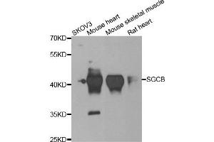 Western blot analysis of extracts of various cell lines, using SGCB antibody. (SGCB 抗体)