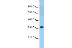 Host: Rabbit Target Name: TACO1 Sample Type: Fetal Kidney lysates Antibody Dilution: 1. (TACO1 抗体  (C-Term))