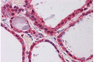 Human Thyroid: Formalin-Fixed, Paraffin-Embedded (FFPE)