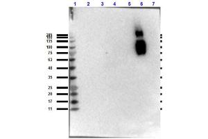 Western Blotting (WB) image for anti-HbBs (N-Term) antibody (ABIN5706738)