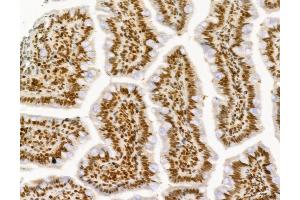 ABIN6261968 and ABIN6277736 at 1/100 staining Rat colon tissue by IHC-P.