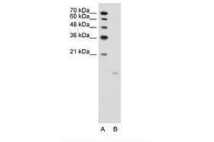 Image no. 1 for anti-PTPRF Interacting Protein, Binding Protein 1 (Liprin beta 1) (PPFIBP1) (AA 41-90) antibody (ABIN203505) (PPFIBP1 抗体  (AA 41-90))