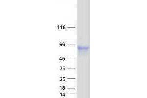 Validation with Western Blot