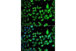 Immunofluorescence analysis of A549 cells using ACCS antibody (ABIN6293455).