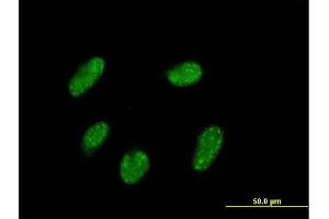 Immunofluorescence of purified MaxPab antibody to VENTX on HepG2 cell. (VENTX 抗体  (AA 1-258))