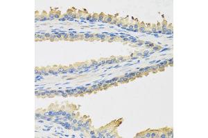 Immunohistochemistry of paraffin-embedded human prostate using LEP antibody (ABIN1876874) at dilution of 1:100 (40x lens). (Leptin 抗体)