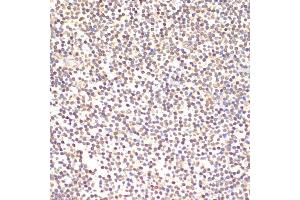 Immunohistochemistry of paraffin-embedded human tonsil using TI antibody (2517) at dilution of 1:100 (40x lens). (TIA1 抗体  (AA 1-193))