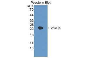 Detection of Recombinant SCEL, Human using Polyclonal Antibody to Sciellin (SCEL) (SCEL 抗体  (AA 519-685))