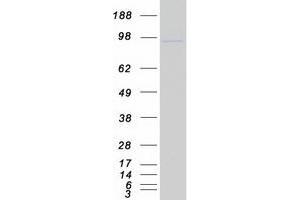 Western Blotting (WB) image for CDC5 Cell Division Cycle 5-Like (S. Pombe) (CDC5L) protein (Myc-DYKDDDDK Tag) (ABIN2713847)