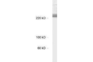 antibody dilution: 1 : 1000, sample: rat hippocampus lysate (CACNA1B 抗体  (alpha-1E subunit))