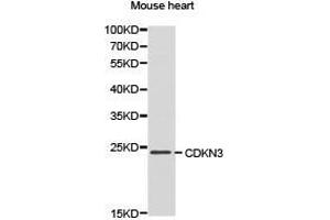 Western Blotting (WB) image for anti-Cyclin-Dependent Kinase Inhibitor 3 (CDKN3) antibody (ABIN1871769) (CDKN3 抗体)