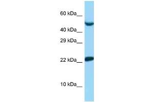 WB Suggested Anti-UBE2E1 Antibody   Titration: 1. (UBE2E1 抗体  (N-Term))