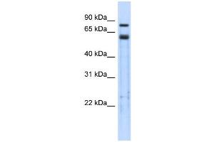 WB Suggested Anti-TRIM9 Antibody Titration:  0. (TRIM9 抗体  (Middle Region))