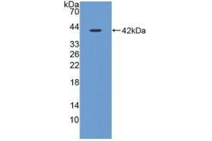 Detection of Recombinant CST3, Porcine using Polyclonal Antibody to Cystatin C (Cys-C) (CST3 抗体  (AA 42-127))