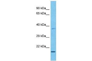 Host:  Rabbit  Target Name:  MXD3  Sample Type:  Esophagus Tumor lysates  Antibody Dilution:  1. (MXD3 抗体  (C-Term))