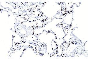 Immunohistochemical analysis of paraffin-embedded Human lung section using SFTPC Antibody (ABIN656267 and ABIN2845580). (Surfactant Protein C 抗体  (N-Term))