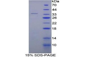 SDS-PAGE of Protein Standard from the Kit (Highly purified E. (SERPINC1 ELISA 试剂盒)