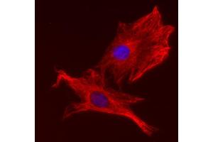 Immunocytochemistry (ICC) image for anti-alpha Tubulin (TUBA1) (AA 443-449) antibody (ABIN1742550) (alpha Tubulin 抗体  (AA 443-449))