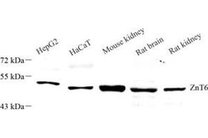 Western blot analysis of Znt6 (ABIN7075673),at dilution of 1: 1000 (SLC30A6 抗体)