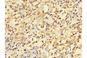 Immunohistochemistry (IHC) image for anti-ATP Citrate Lyase (ACLY) (AA 4-265) antibody (ABIN7144946)