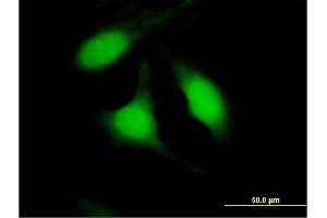 Immunofluorescence of purified MaxPab antibody to PSME2 on HeLa cell. (PSME2 抗体  (AA 1-239))