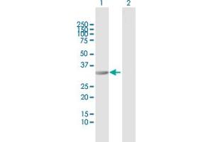 Western Blot analysis of RIMKLB expression in transfected 293T cell line by RIMKLB MaxPab polyclonal antibody. (RIMKLB 抗体  (AA 1-307))