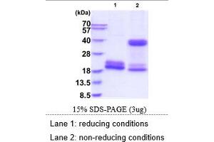 SDS-PAGE (SDS) image for Killer Cell Lectin-Like Receptor Subfamily D, Member 1 (KLRD1) (AA 32-179) protein (His tag) (ABIN6388105)