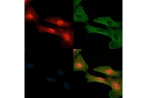 ABIN6258843 and ABIN6274212 staining  cells(H2O2 treatment) by IF/ICC. (HMGB2 抗体  (Internal Region))