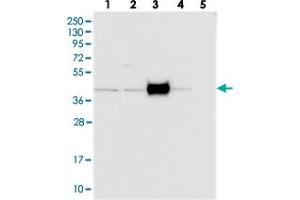 Western blot analysis of Lane 1: RT-4, Lane 2: U-251 MG, Lane 3: Human Plasma, Lane 4: Liver, Lane 5: Tonsil with FAM154B polyclonal antibody  at 1:250-1:500 dilution. (FAM154B 抗体)