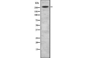 Western blot analysis of WBP7 using HuvEc whole cell lysates