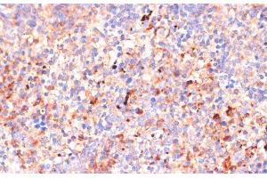 Immunohistochemistry of paraffin-embedded Mouse spleen using IL4R Polyclonal Antibody at dilution of 1:100 (40x lens). (IL4 Receptor 抗体)