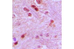 Immunohistochemistry (IHC) image for anti-General Transcription Factor IIIC, Polypeptide 3, 102kDa (GTF3C3) (N-Term) antibody (ABIN7297578)