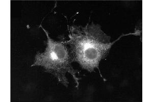 Immunofluorescence staining transiently Kv1.