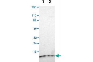 Western Blot analysis of Lane 1: RT-4 and Lane 2: U-251MG sp cell lysates with TIMM8A polyclonal antibody . (TIMM8A/DDP 抗体)