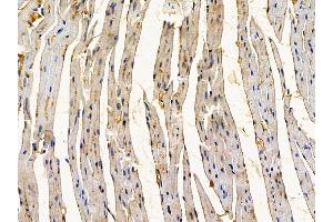 ABIN6262430 and ABIN6278873 at 1/100 staining mouse heart tissue by IHC-P.