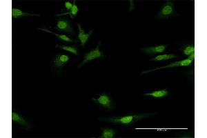 Immunofluorescence of purified MaxPab antibody to COQ3 on HeLa cell. (COQ3 抗体  (AA 1-369))