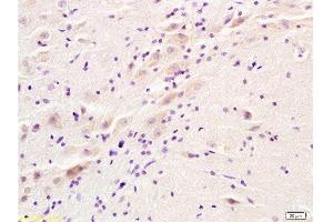 Formalin-fixed and rat brain tissue labeled with Anti-ADRA2 Polyclonal Antibody, Unconjugated  at 1:200 followed by conjugation to the secondary antibody and DAB staining (ADRA2A 抗体  (AA 385-450))