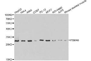 Western blot analysis of extracts of various cell lines, using PSMA6 antibody. (PSMA6 抗体  (AA 1-246))