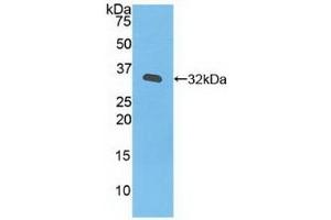 Detection of Recombinant JAK3, Human using Polyclonal Antibody to Janus Kinase 3 (JAK3) (JAK3 抗体  (AA 716-967))