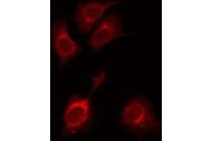 ABIN6275568 staining HuvEc by IF/ICC. (SH3RF3 抗体  (C-Term))