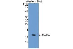 Detection of Recombinant SLC30A5, Mouse using Polyclonal Antibody to Solute Carrier Family 30, Member 5 (SLC30A5) (SLC30A5 抗体  (AA 639-751))