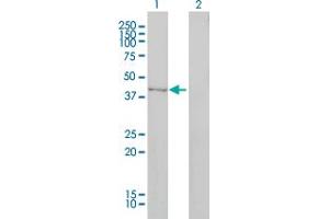 Western Blot analysis of DNMT2 expression in transfected 293T cell line by DNMT2 monoclonal antibody (M01), clone 1E12. (Dnmt2 抗体  (AA 1-391))