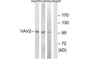 Western Blotting (WB) image for anti-Vav 2 Guanine Nucleotide Exchange Factor (VAV2) (AA 108-157) antibody (ABIN2888936) (VAV2 抗体  (AA 108-157))