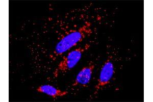 Proximity Ligation Analysis of protein-protein interactions between PRKCZ and AKT3. (PKC zeta 抗体  (AA 1-592))