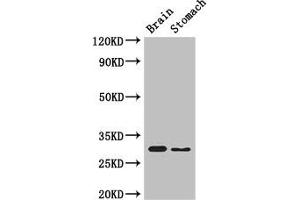 Western Blot Positive WB detected in: Mouse brain tissue, Mouse stomach tissue All lanes: COPS7B antibody at 3 μg/mL Secondary Goat polyclonal to rabbit IgG at 1/50000 dilution Predicted band size: 30, 19, 31 kDa Observed band size: 30 kDa (COPS7B 抗体  (AA 1-157))