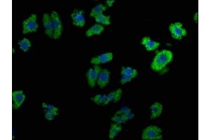 Immunofluorescence staining of HepG2 cells with ABIN7139920 at 1:100, counter-stained with DAPI. (LPAR6 抗体  (AA 292-313))