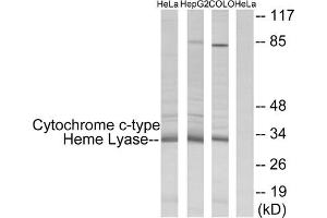 Western blot analysis of extracts from HeLa cells, HepG2 cells and COLO cells, using Cytochrome c-type Heme Lyase antibody. (HCCS 抗体  (Internal Region))
