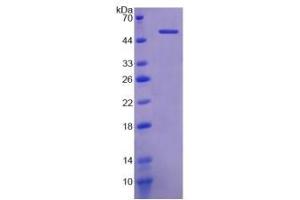 SDS-PAGE of Protein Standard from the Kit  (Highly purified E. (Klotho ELISA 试剂盒)